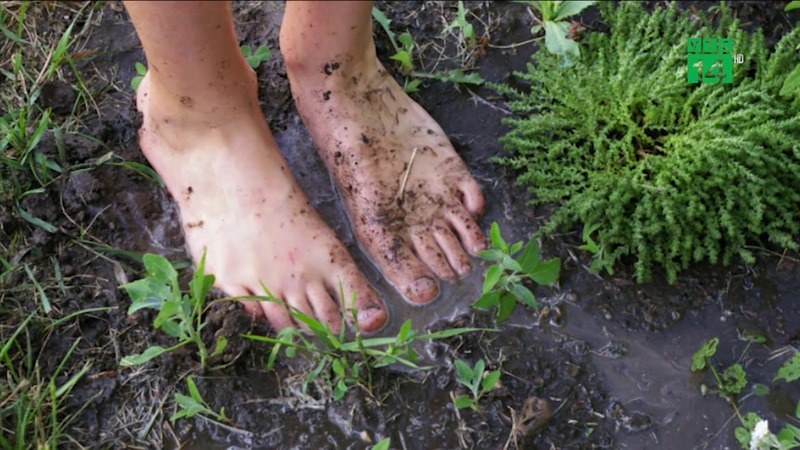 Ghi nhận một trường hợp bệnh nhi tử vong vì bệnh Whitmore