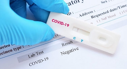 Vietnam can test 13,000 Covid-19 samples for the corona virus 2019 a day